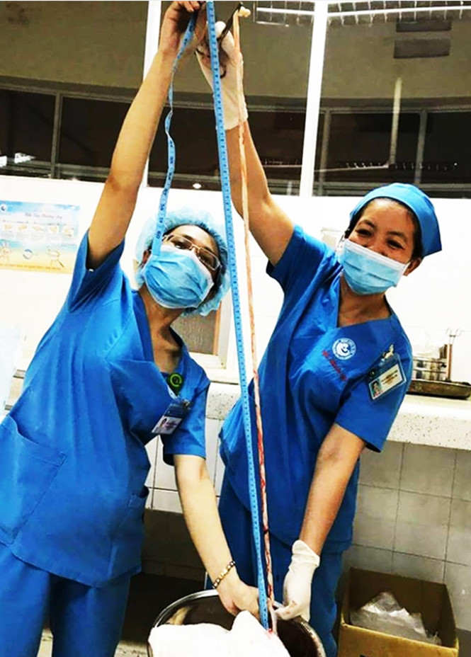 mot be gai vua moi sinh o tp hcm co day ron dai ky luc hon 1m