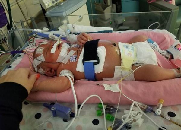 chi vi nu hon cua nguoi la be gai nay da qua doi khi moi duoc 18 ngay tuoi