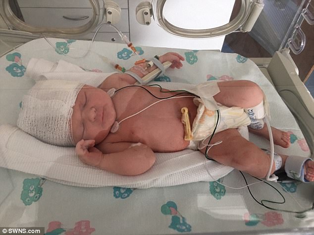 me de mo be gai bi dao rach mot vet dai ngay gan mat