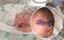 me de mo be gai bi dao rach mot vet dai ngay gan mat