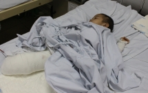gia dinh o son la bi sat lo nui san bang nha cua me nguy kich con trai 4 tuoi phai cat cut 2 chan