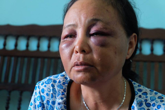 nguoi phu nu ban tam bi danh oan vi tuong bat coc tre em chi vi loi 1 co gai ma ho lao vao dam da tui bui chung toi