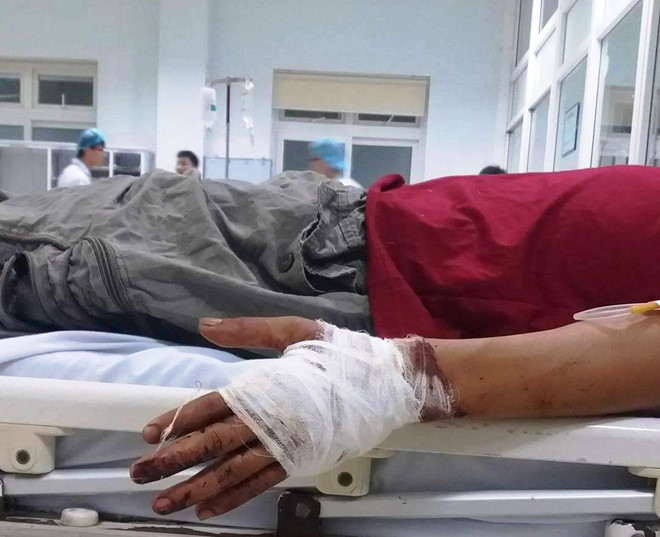 nghe an tranh gianh khach ra dao che hai chu tau chem nhau dut gan lia tay