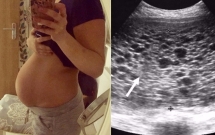 mang thai 3 thang trong bung di sieu am moi thay minh dang mang chum nho su that khien ca nha nga ngua