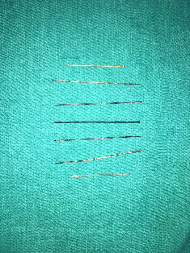 be gai 3 tuoi thiet mang vi me nhan tam lay kim choc len than the con lam bup be ta thuat