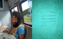 be gai 3 tuoi thiet mang vi me nhan tam lay kim choc len than the con lam bup be ta thuat