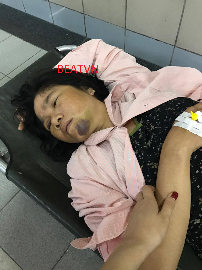 lien tuc hoang loan nguoi phu nu bi danh oan vi nghi bat coc tre em phai vao bv bach mai chup chieu