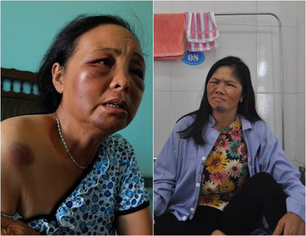 lien tuc hoang loan nguoi phu nu bi danh oan vi nghi bat coc tre em phai vao bv bach mai chup chieu