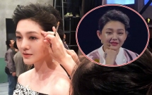 tu hy vien beo den hip mat hay do di chung cua phau thuat tham my