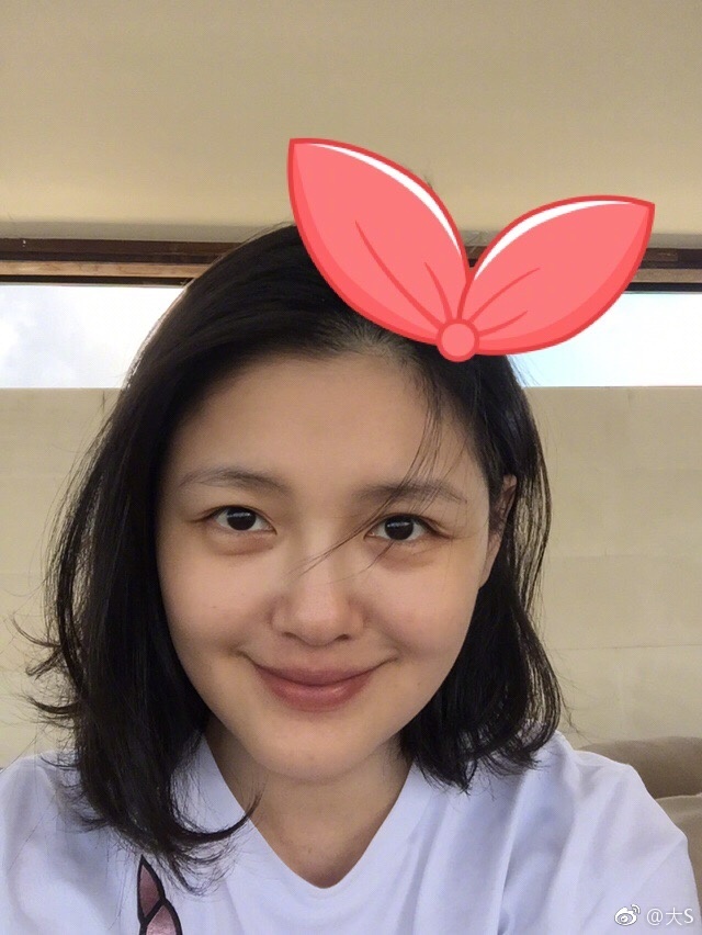 tu hy vien beo den hip mat hay do di chung cua phau thuat tham my