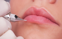 vu nguyen nu dai bieu quoc hoi qua doi sau khi di lam dep tren duong ve co uong thuoc giam dau