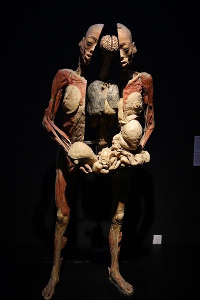 trien lam xac nguoi thai nhi dang dien ra tai tphcm khien nhieu nguoi am anh