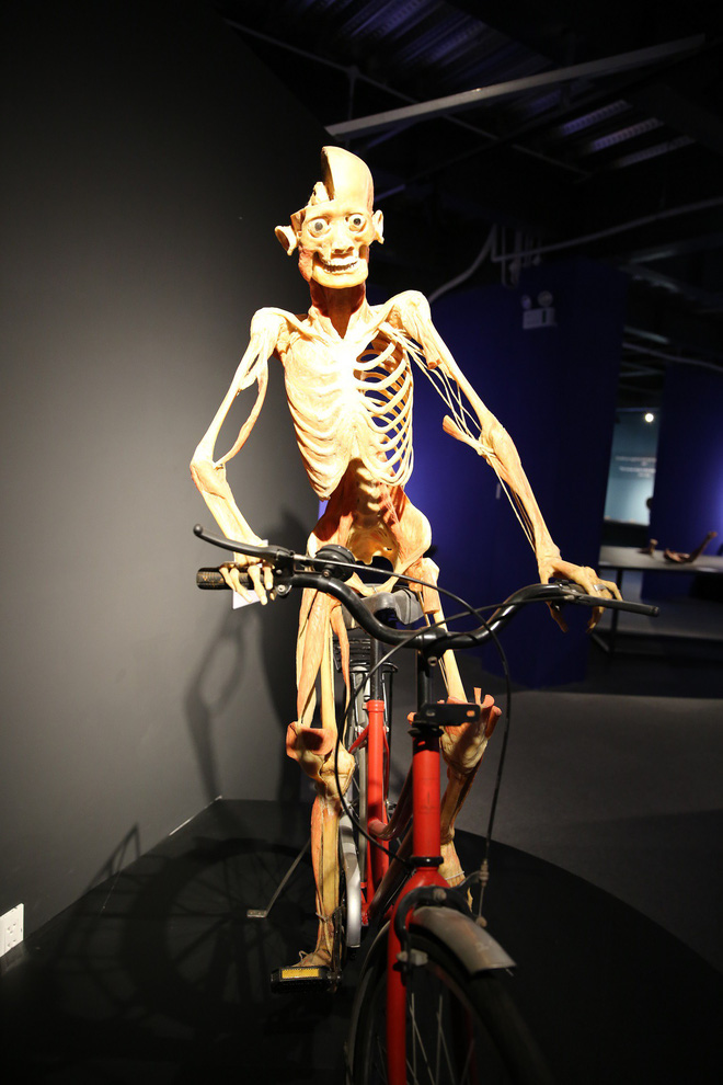 trien lam co the va noi tang cua xac nguoi that duoc nhua hoa o sai gon gay tranh cai