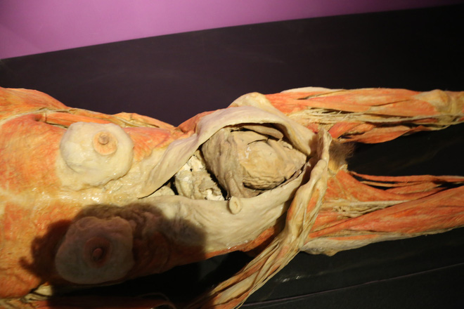 tam ngung hoat dong trien lam xac nguoi that o sai gon