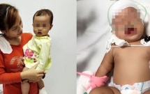 tphcm be gai bi khi nha hang xom can lun so da duoc ve nha