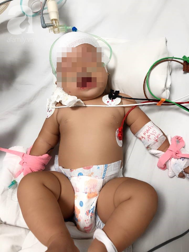 tphcm be gai bi khi nha hang xom can lun so da duoc ve nha