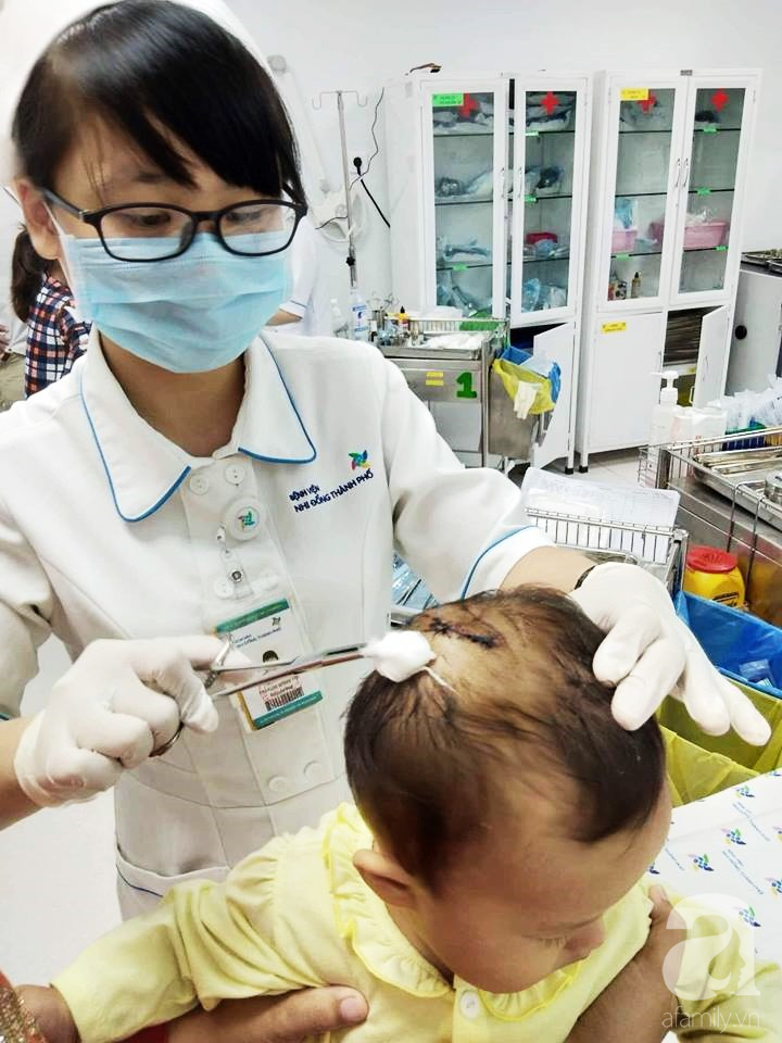 tphcm be gai bi khi nha hang xom can lun so da duoc ve nha