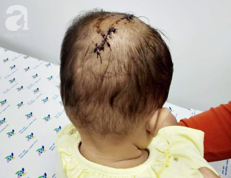 tphcm be gai bi khi nha hang xom can lun so da duoc ve nha