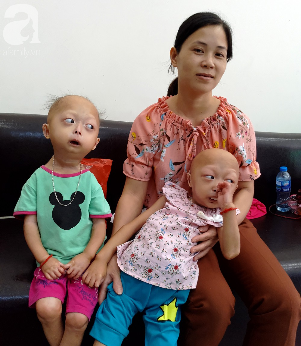 me cua 2 be gai bi dau co veo lech o tuyen quang gia nhu con khoi benh du danh doi gi toi cung cam long