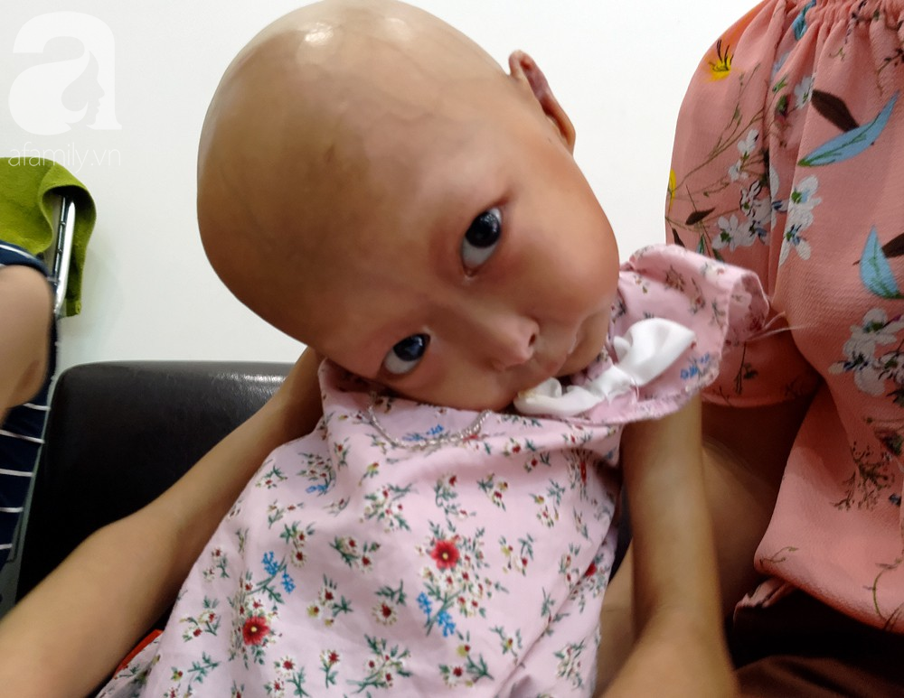 me cua 2 be gai bi dau co veo lech o tuyen quang gia nhu con khoi benh du danh doi gi toi cung cam long