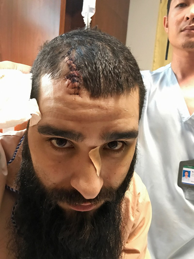 dao dien kong tu dieu tra vu bi danh o sai gon cong bo chi tiet gay soc lien quan xa hoi den