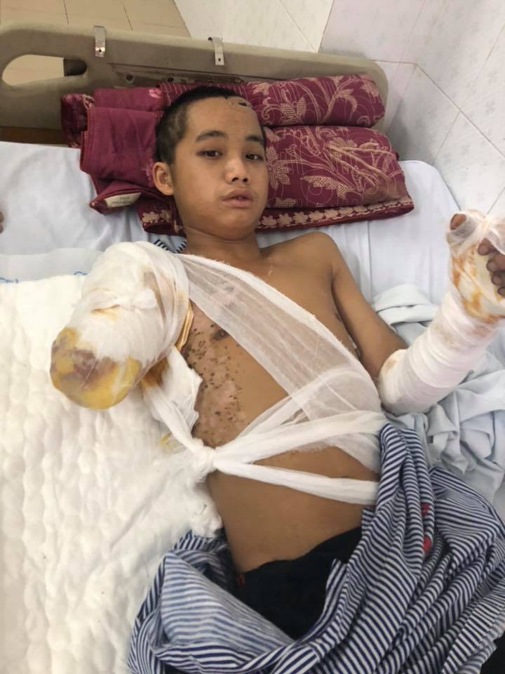 bo chet me bo di bien biet chang trai dang mot minh nuoi 5 em nho bong bi dien giat cut tay song lay lat