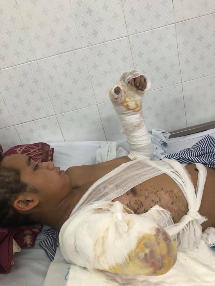 bo chet me bo di bien biet chang trai dang mot minh nuoi 5 em nho bong bi dien giat cut tay song lay lat