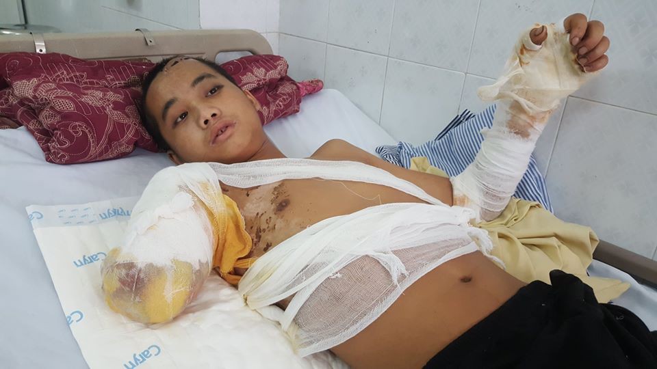 bo chet me bo di bien biet chang trai dang mot minh nuoi 5 em nho bong bi dien giat cut tay song lay lat