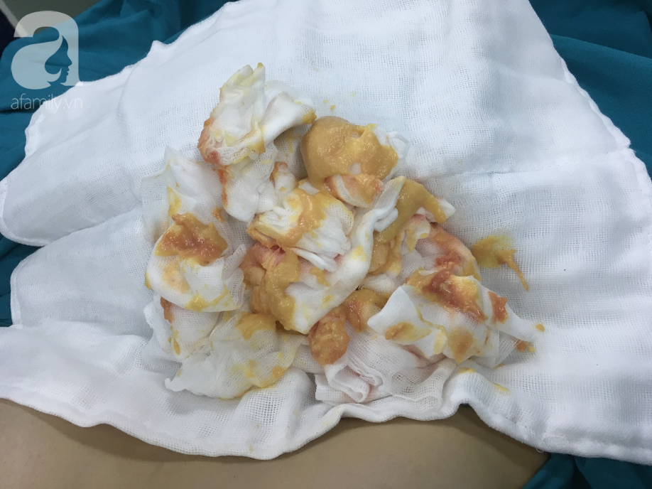 sang thai lan bom mo nhan tao nu viet kieu bi hoai tu nguc nang