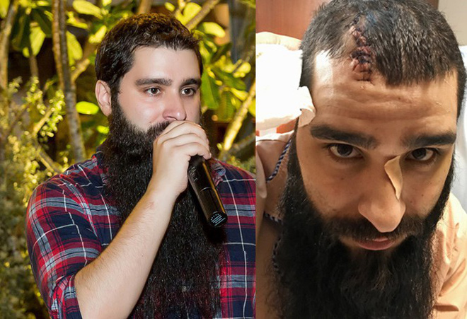 2 viet kieu cam dau vu danh dao dien kong duoc xac dinh da bo tron khoi viet nam