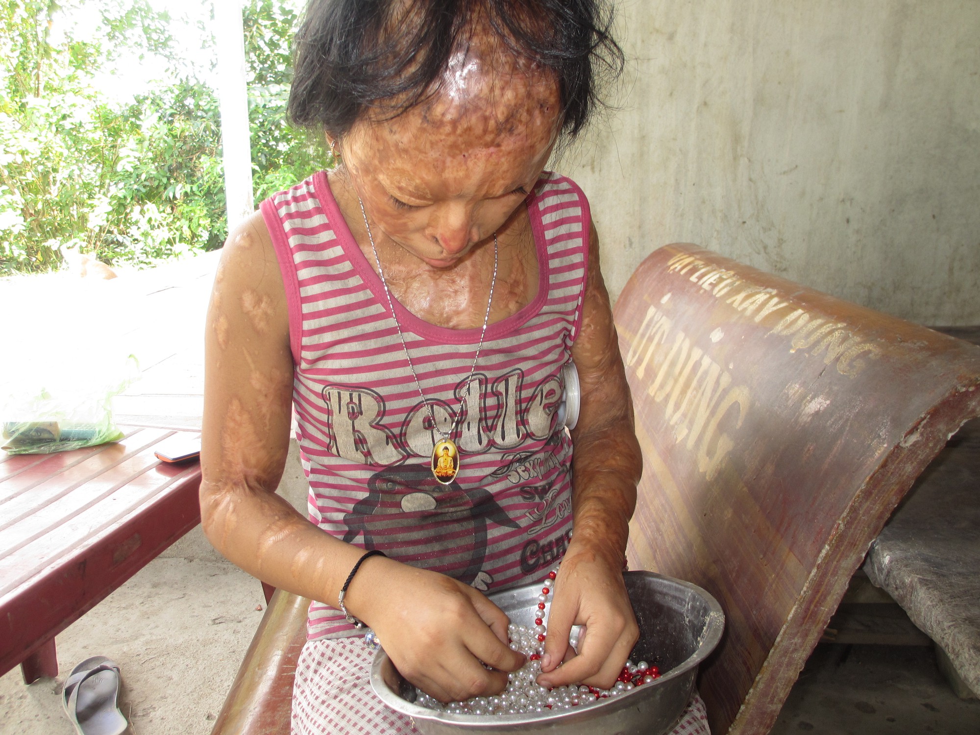 ba noi be gai bi tat axit nam 7 tuoi vi me giat chong nguoi khac toi muon xin doi mat cua tu tu nguyen huu tinh de cuu chau