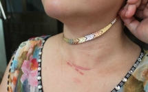 giat day chuyen bat thanh ten cuop dap nguoi me cung be trai 3 tuoi roi xuong kenh o sai gon