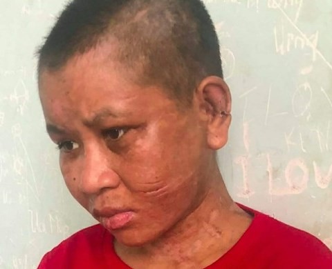 co gai to bi chu tra tan ba chu dung ca cay go da dong dinh dap len dau len mat