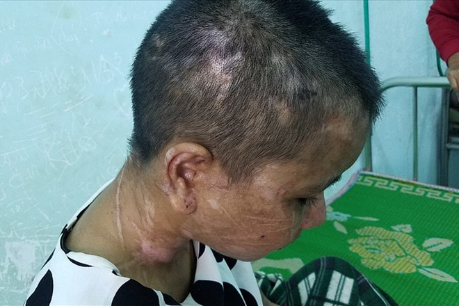 nu chu nha bi to tra tan da man nguoi lam thue noi nhieu da bo thuoc thu vao thuc an cua ba