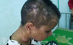 nu chu nha bi to tra tan da man nguoi lam thue noi nhieu da bo thuoc thu vao thuc an cua ba