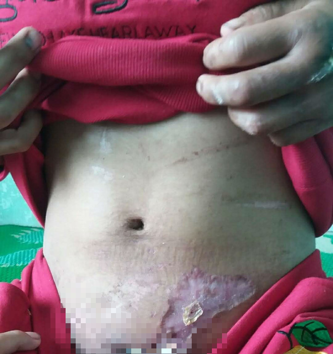 nu chu nha bi to tra tan da man nguoi lam thue noi nhieu da bo thuoc thu vao thuc an cua ba