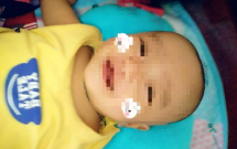 vu be trai 4 thang tuoi tu vong o benh vien bac si ban xu tri 1 ca khac nen chi dao mieng de dieu duong xu ly