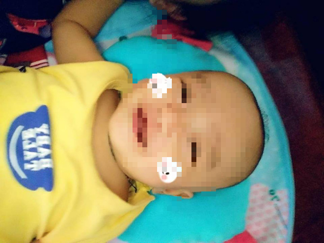 vu be trai 4 thang tuoi tu vong o benh vien bac si ban xu tri 1 ca khac nen chi dao mieng de dieu duong xu ly