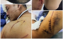 hai phong nguoi dan ong to bi nhom con do dung dao kiem chem guc tai quan ca phe