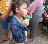 uong sua bi non be gai 5 tuoi bi co giao mam non tat ran xuong ham