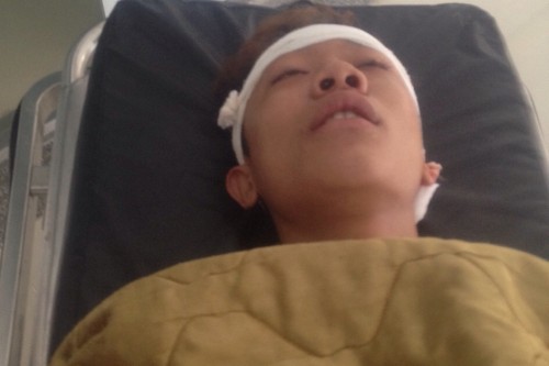 nghe an tren duong ve nha nam thanh nien bi cac doi tuong trom cho danh mop hop so