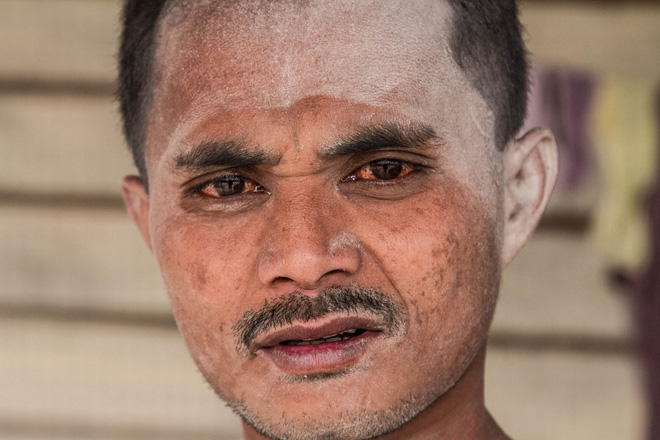 chi sau mot dem ca thi tran o indonesia bong mu mit nhu ngay tan the