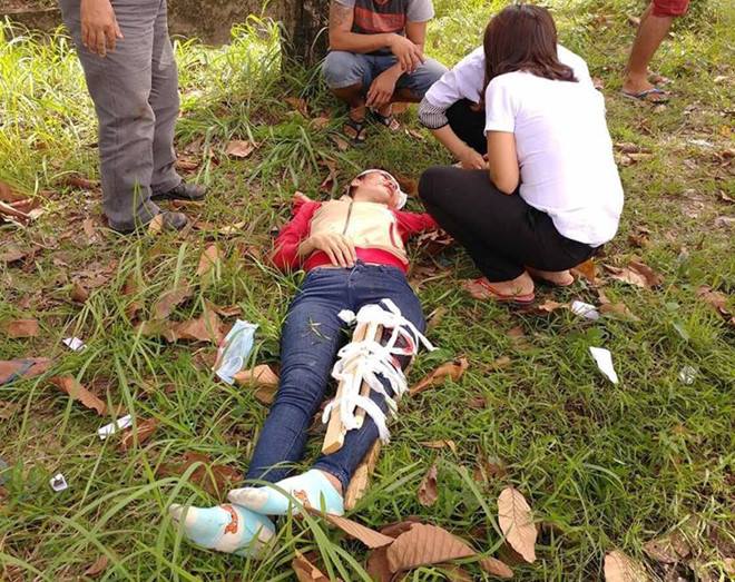 nu cong nhan bi gay chan khi duoi theo ke cuop chung con quay mat lai gieu cot thach thuc toi