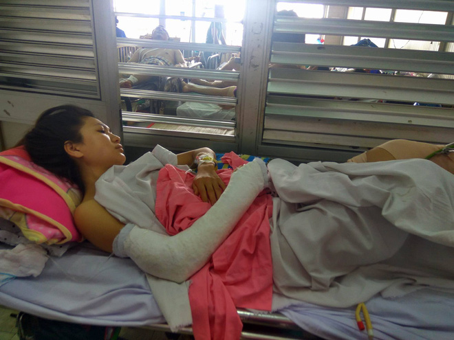 nu cong nhan bi gay chan khi duoi theo ke cuop chung con quay mat lai gieu cot thach thuc toi