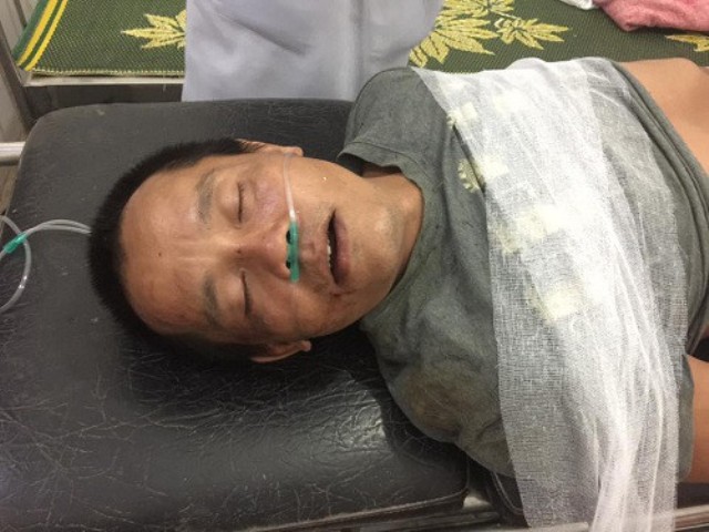 xem facebook gia dinh moi biet nguoi than bi tai nan giao thong chan thuong so nao