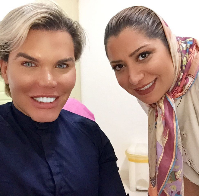 nhin ve ngoai moi cua bup be ken brazil nguoi ta se lam tuong la sinh vat ngoai hanh tinh