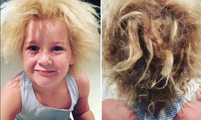 be gai mac benh toc phan chu moc nhu choi rom