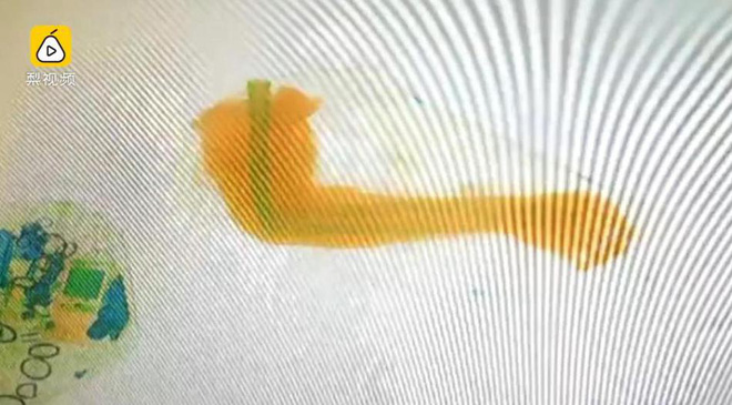 khach de do len may soi nhan vien an ninh bang hoang phat hien ra 2 canh tay nguoi trong tui hanh ly