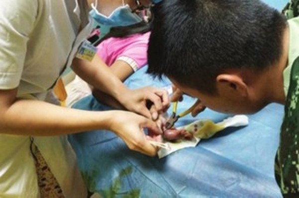 chi vi mot chiec nhan re tien be gai nay suyt mat ca ngon tay cua minh