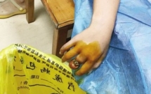 chi vi mot chiec nhan re tien be gai nay suyt mat ca ngon tay cua minh